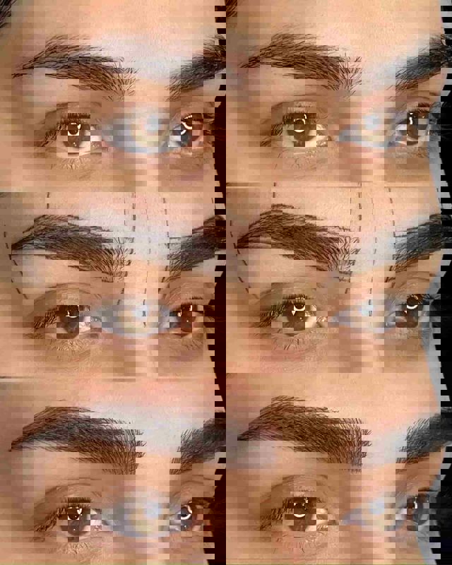 میکروبلیدینگ